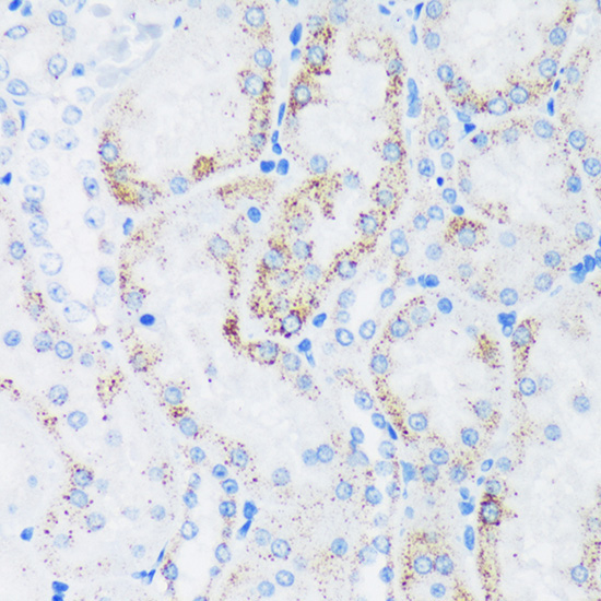 GTPBP8 Rabbit Polyclonal Antibody - Image 3