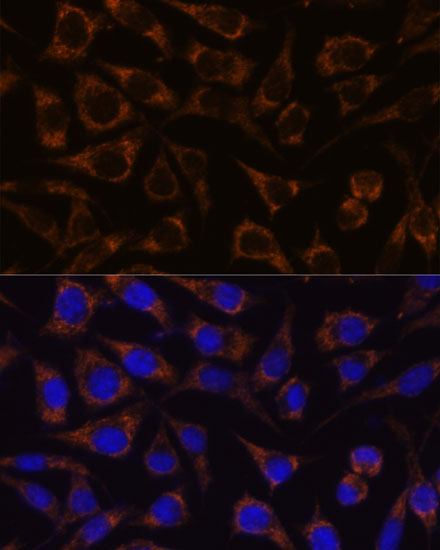 GTPBP8 Rabbit Polyclonal Antibody - Image 4
