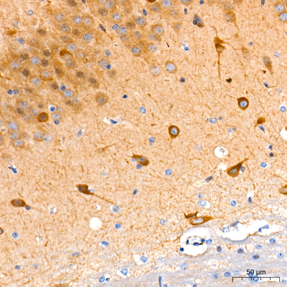 Guanylyl Cyclase beta 1 (GUCY1B3) Rabbit Monoclonal Antibody - Image 2