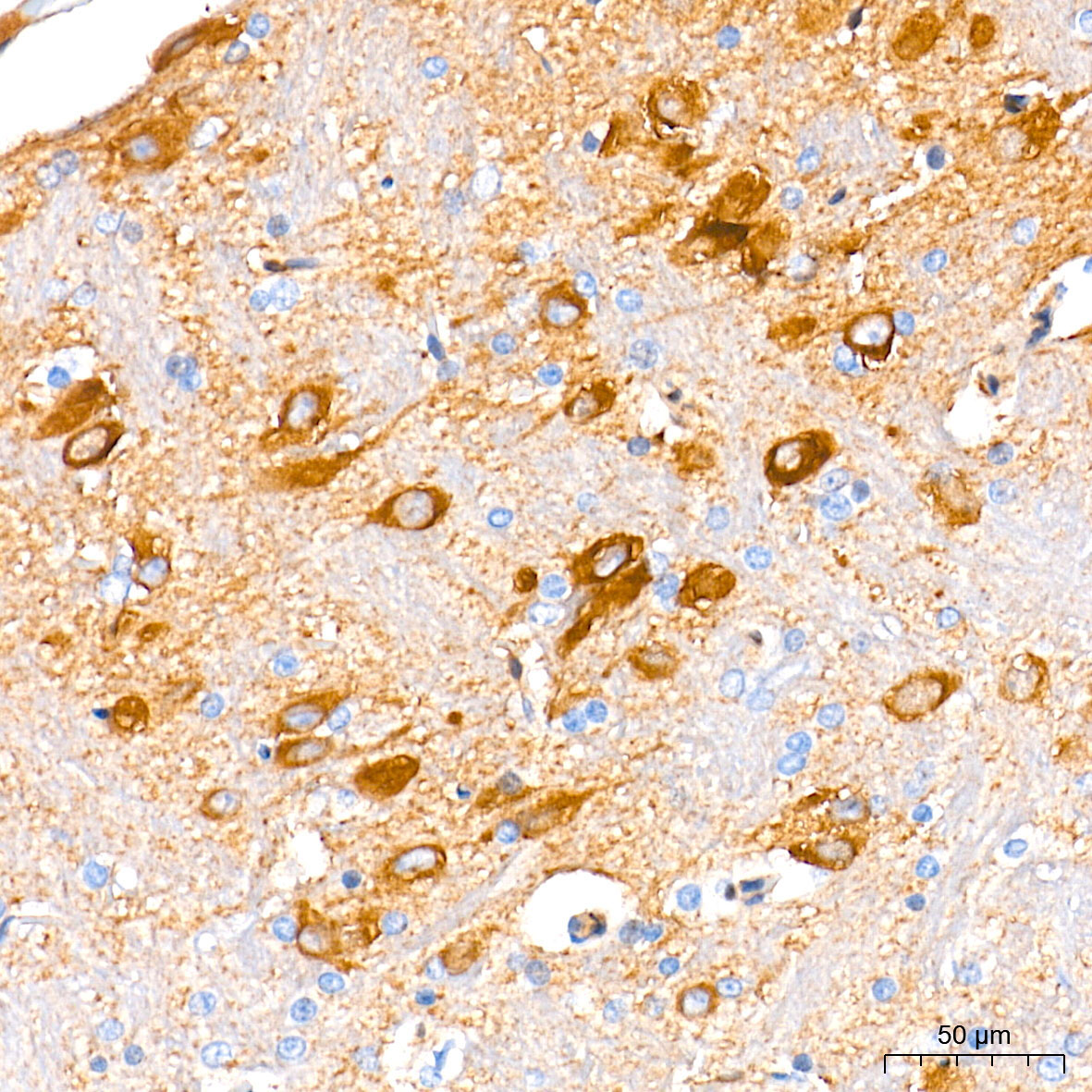 Guanylyl Cyclase beta 1 (GUCY1B3) Rabbit Monoclonal Antibody - Image 3