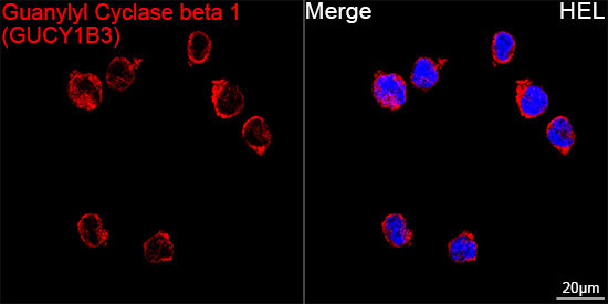 Guanylyl Cyclase beta 1 (GUCY1B3) Rabbit Monoclonal Antibody - Image 4