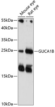 GUCA1B Rabbit Polyclonal Antibody