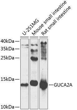 GUCA2A Rabbit Polyclonal Antibody