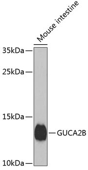 GUCA2B Rabbit Polyclonal Antibody