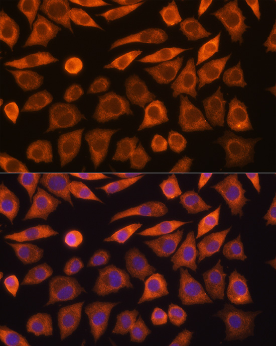 GUCY1A3 Rabbit Polyclonal Antibody - Image 2