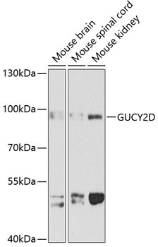 GUCY2D Rabbit Polyclonal Antibody