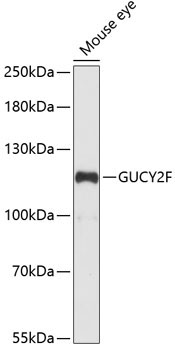 GUCY2F Rabbit Polyclonal Antibody