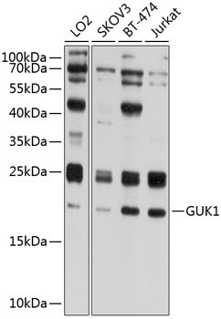 GUK1 Rabbit Polyclonal Antibody