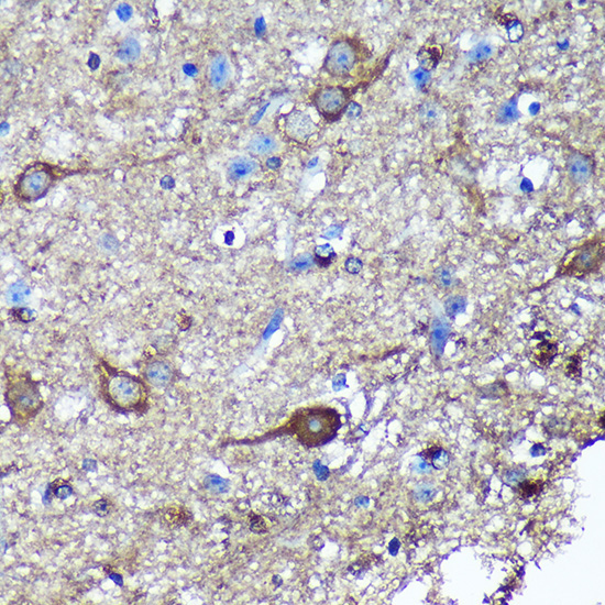 GULP1 Rabbit Polyclonal Antibody - Image 2