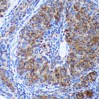 GULP1 Rabbit Polyclonal Antibody - Image 3