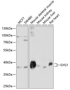 GYG1 Rabbit Polyclonal Antibody