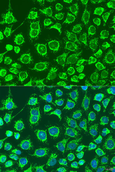 GYPB Rabbit Polyclonal Antibody
