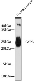 GYPB Rabbit Polyclonal Antibody