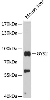 GYS2 Rabbit Polyclonal Antibody