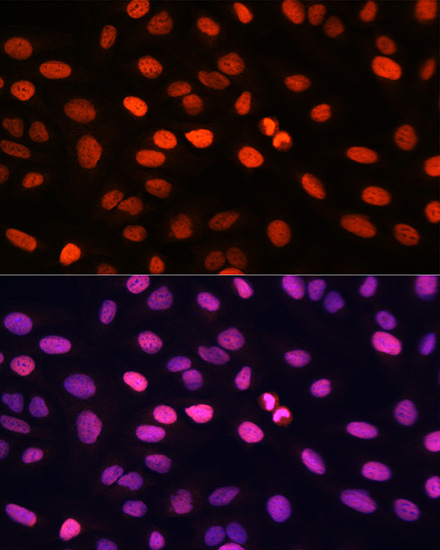 H3Q5ser Rabbit Polyclonal Antibody - Image 3