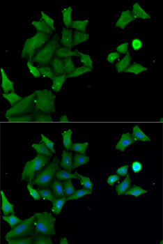 HABP2 Rabbit Polyclonal Antibody