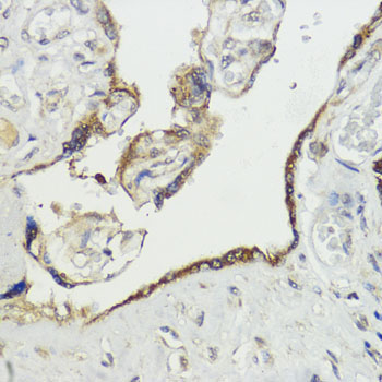 HACE1 Rabbit Polyclonal Antibody - Image 2