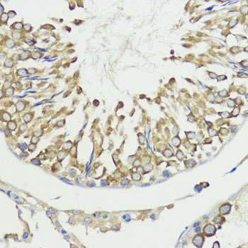 HACE1 Rabbit Polyclonal Antibody - Image 3