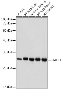 HADH Rabbit Polyclonal Antibody