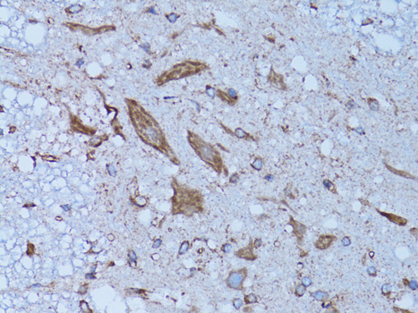 HADH Rabbit Polyclonal Antibody - Image 2