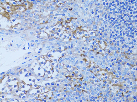 HADH Rabbit Polyclonal Antibody - Image 3