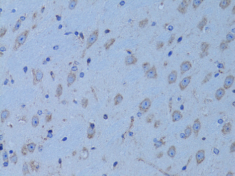 HADH Rabbit Polyclonal Antibody - Image 4