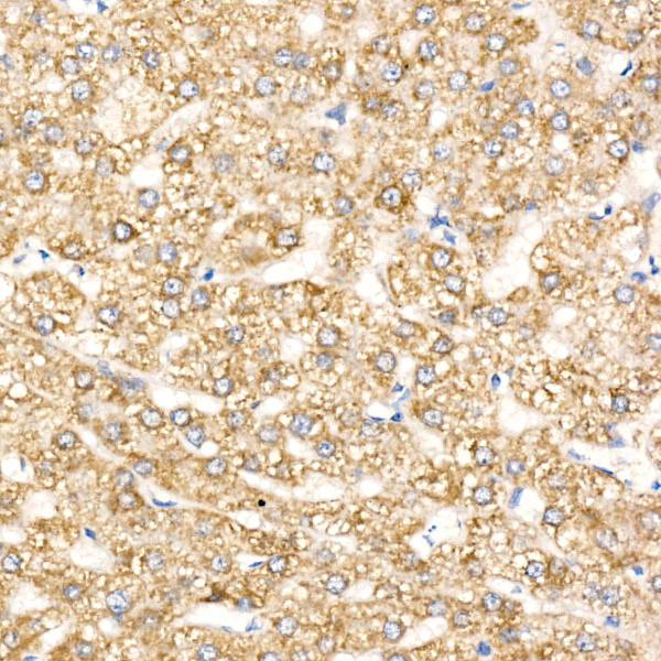 HADHA Rabbit Polyclonal Antibody - Image 2