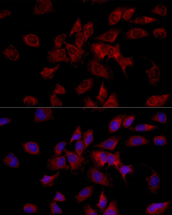 HADHA Rabbit Polyclonal Antibody - Image 3