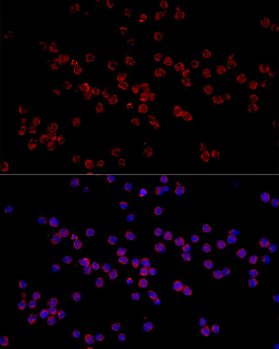 HADHA Rabbit Polyclonal Antibody - Image 4