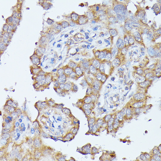 HAL Rabbit Polyclonal Antibody - Image 3