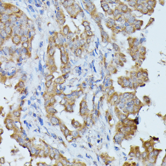 HAL Rabbit Polyclonal Antibody - Image 4