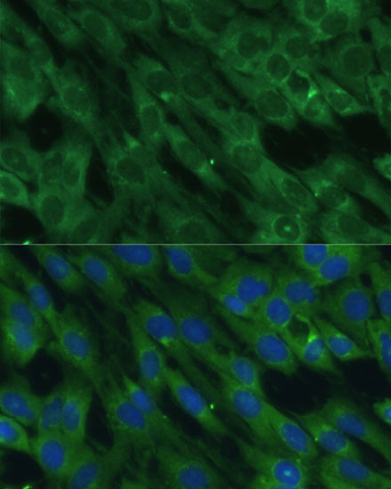 HAL Rabbit Polyclonal Antibody - Image 6