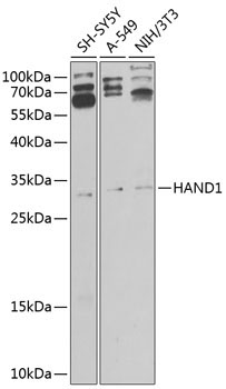 HAND1 Rabbit Polyclonal Antibody
