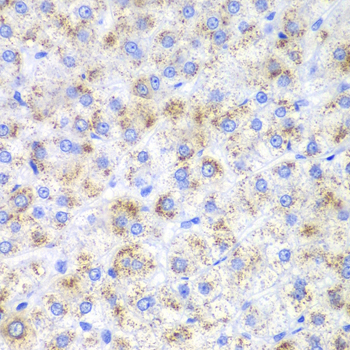 HAO1/GOX Rabbit Polyclonal Antibody - Image 2
