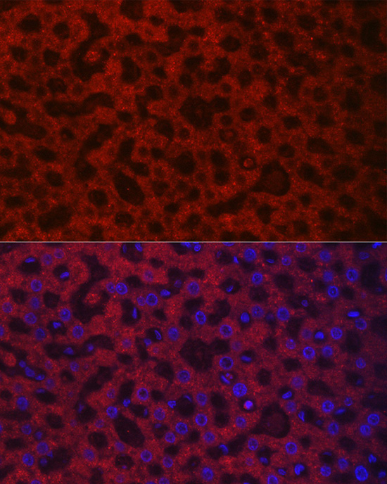 HAO1/GOX Rabbit Polyclonal Antibody - Image 3