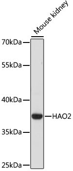 HAO2 Rabbit Polyclonal Antibody