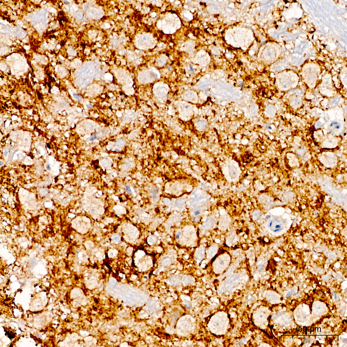 HAPLN1 Rabbit Polyclonal Antibody - Image 2