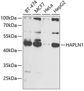 HAPLN1 Rabbit Polyclonal Antibody