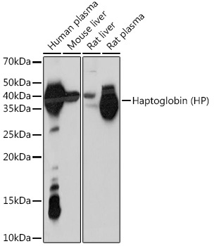 Haptoglobin (HP) Rabbit Monoclonal Antibody