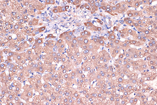 Haptoglobin (HP) Rabbit Monoclonal Antibody - Image 2