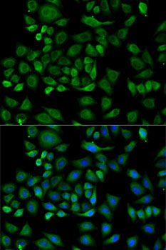 Haptoglobin (HP) Rabbit Polyclonal Antibody