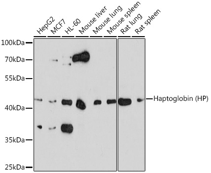Haptoglobin (HP) Rabbit Polyclonal Antibody