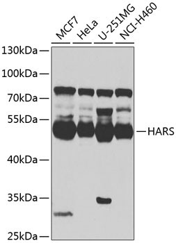 HARS Rabbit Polyclonal Antibody