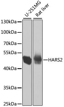 HARS2 Rabbit Polyclonal Antibody