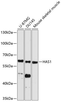 HAS1 Rabbit Polyclonal Antibody
