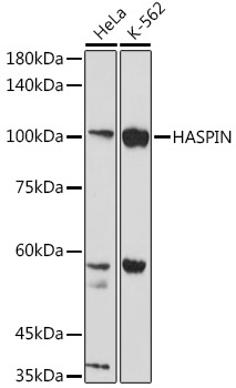 HASPIN Rabbit Polyclonal Antibody