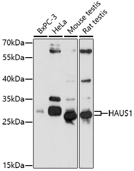 HAUS1 Rabbit Polyclonal Antibody