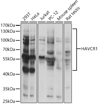 HAVCR1 Rabbit Polyclonal Antibody