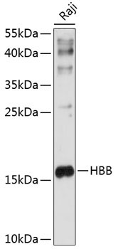 HBB Rabbit Polyclonal Antibody