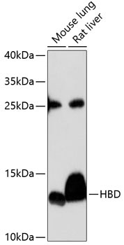 HBD Rabbit Polyclonal Antibody